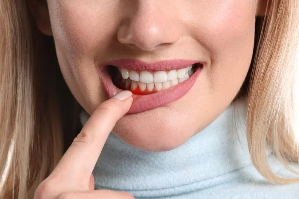 Imagine pentru articolul „Cum se folosește corect ața dentară”